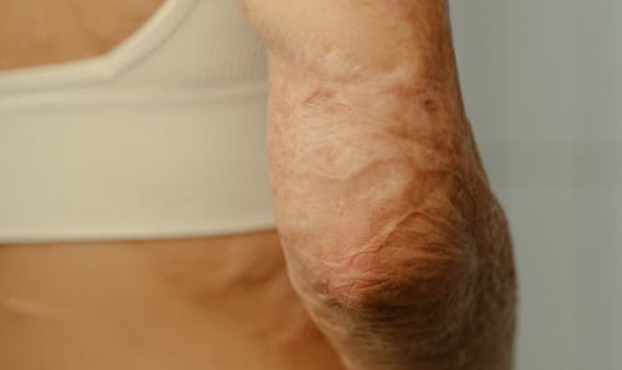 The Role of Electrophysiology in Healing